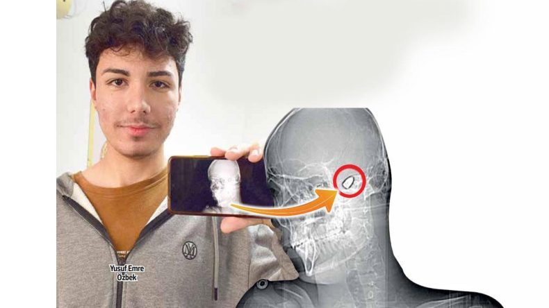 1.5 Yıldır Ölüm Tehlikesiyle Yaşayan Genç