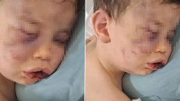 2 Yaşındaki Bebek Korkunç Bir Olayla Hastanelik Oldu!