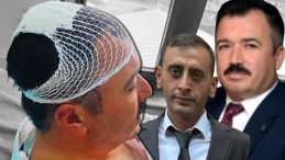 Belediye Başkan Yardımcısını Şekerlikle Yaraladı! İl Başkan Yardımcısı Tutuklandı