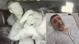 İngiliz Boksörün Darbettiği Taksi Şoförü Dehşeti Anlattı