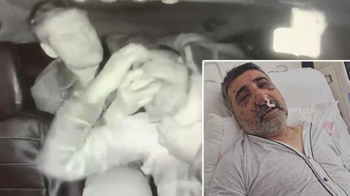 İngiliz Boksörün Darbettiği Taksi Şoförü Dehşeti Anlattı