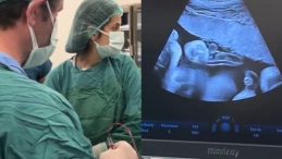 Anne Karnındaki Bebeğe Kan Nakli Yapıldı
