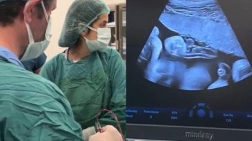 Anne Karnındaki Bebeğe Kan Nakli Yapıldı