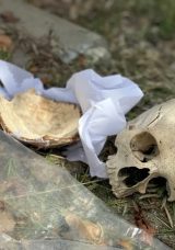 Çöpte Bulunan Kafatasının Gizemi Aydınlandı: Doktor 31 Yıl Önce Mezarlıktan Eğitim İçin Almış