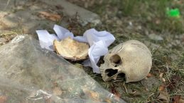 Çöpte Bulunan Kafatasının Gizemi Aydınlandı: Doktor 31 Yıl Önce Mezarlıktan Eğitim İçin Almış