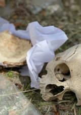 Çöpten Kafatası Bulundu! Polis Harekete Geçti…