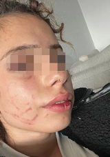 Dayakçı Sevgiliye 19 Yıl Hapis Talebi