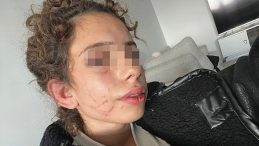 Dayakçı Sevgiliye 19 Yıl Hapis Talebi