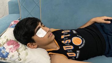 Neye uğradığını şaşırdı! Yapıştırıcı sıçrayınca kapanan göz kapağı doktor müdahalesiyle açıldı