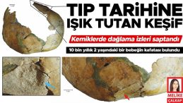 Tıp Tarihinde Çığır Açan Keşif