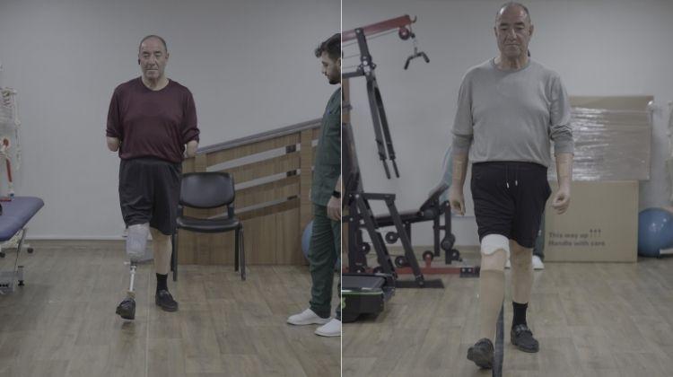 Üç Uzvunu Kaybetti Ama Pes Etmedi, Yeniden Hayata Tutundu