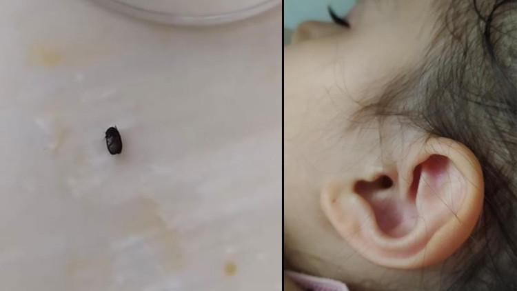 3 Yaşındaki Çocuğun Kulağına Kene Yapıştı! İzmit'te Kene Alarmı