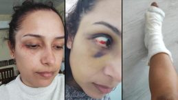 Adana’da Genç Öğretmenin Hayatı Kabusa Dönüştü: ‘Hamileyken Dövdü, Ayağım Kırıldı, Bebeğimi Kaçırdı’