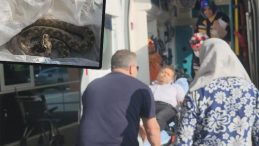 Ailesiyle Piknikte Yılan Saldırısına Uğradı