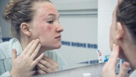 Cildiniz Kızarıyorsa Dikkat! O Ölümcül Durumun Belirtisi Olabilir…