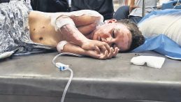 Çocukları Hedef Aldı: 51 Can Kaybı