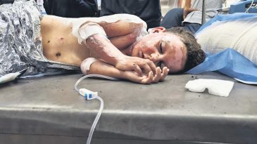 Çocukları Hedef Aldı: 51 Can Kaybı