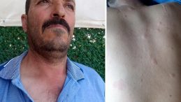 Duyduğu Seslere Giden Çiftçi, Hayatının Şokunu Yaşadı!