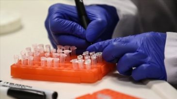 Gana’da 34 M Çiçeği Vakası Tespit Edildi