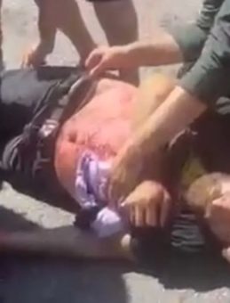 Gaziantep’te Bıçaklarla Çatışma! Bir Kişi Göğsünden Yaralandı, Hayatını Kaybetti