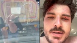 Genç oyuncu 4 kişi tarafından trafikte darbedildi! 'Öldürene kadar döveceklerdi'