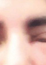 Güzelleşmek İçin Gitti Tanınmaz Hale Geldi