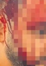 Kavgayı Ayırmak İsterken Darp Edildi