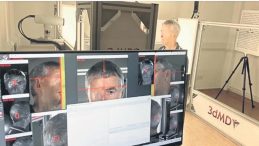 Kaza geçiren bisikletçiye 3D yazıcı ile yeni yüz