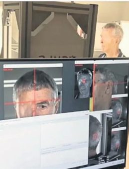 Kaza geçiren bisikletçiye 3D yazıcı ile yeni yüz