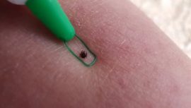 Kene Isırmalarına Karşı En Etkili Önlemler!