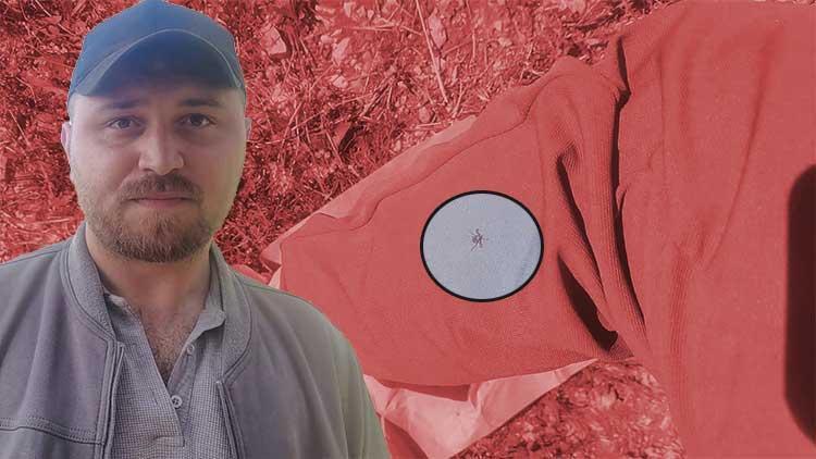 Kene Kabusu Devam Ediyor: Keneler Koku Alıp Üzerimize Geliyor