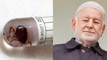 Koltuk Altına Kene Yapıştı, Hayatını Kaybetti