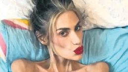 Nihal Candan’ı Estetik Kaygısı mı Öldürdü?