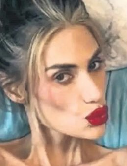 Nihal Candan’ı Estetik Kaygısı mı Öldürdü?