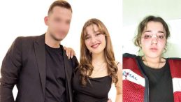 Nişanlı Korkusu… Yüzüne Kafa Attı, Kaskıyla Darp Etti