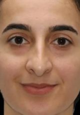 Polis memuru Burcu Ertem tedavi gördüğü hastanede hayatını kaybetti