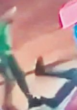 Yumruk Attı, Kalp Masajı Yaptı