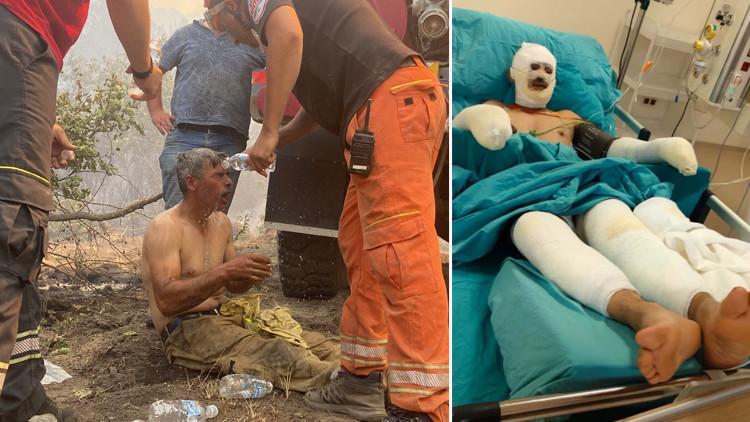 'Yanıyorum, su verin' feryatlarıyla yürekleri dağlamıştı! Orman işçisi Kader Dereli'nin son hali paylaşıldı