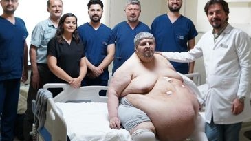 310 kiloya ulaşan adamın dramı son buluyor! Duyduğu c&uuml;mle hayatını değiştirdi | 'Yeri geldi &ouml;lmek i&ccedil;in dua ettim'