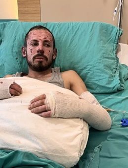 Arızalı Araçla Yaşanan Kaza Bedirhan Acar'ı Yaraladı