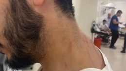 Beyoğlu&rsquo;nda Sigara İ&ccedil;me Tartışması Kavgaya D&ouml;n&uuml;şt&uuml;