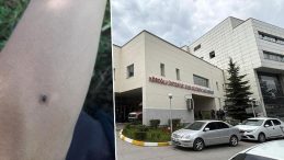 Bir Kene Vakası Daha: 77 Yaşındaki Kadın Hayatını Kaybetti