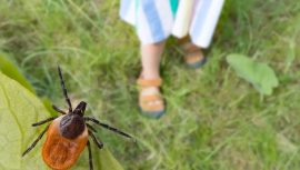 Bu Belirtiler Ortaya Çıkarsa İhmal Etmeyin! Kene Isırığı Hayati Risk Taşıyabilir…