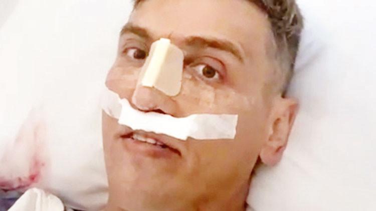 Burun Ameliyatı Felaketi