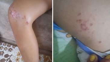 Denizden &ccedil;ıkan &ccedil;ocuk bir anda fenalaştı, korkun&ccedil; ger&ccedil;ek muayenede &ouml;ğrenildi