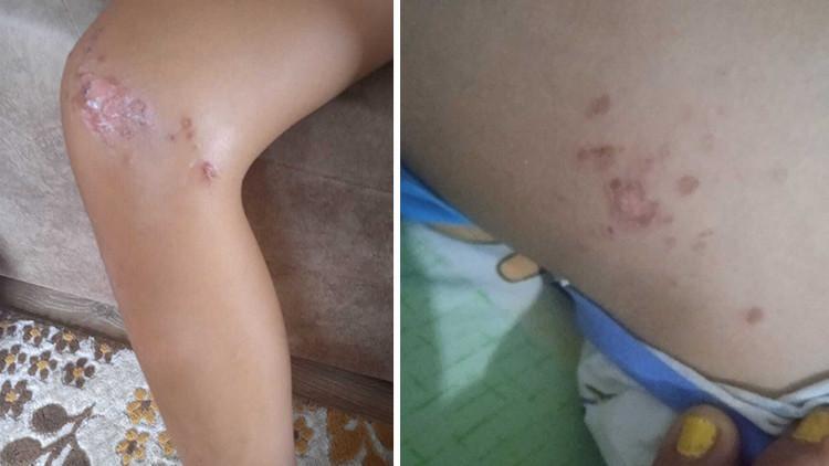 Denizden çıkan çocuk bir anda fenalaştı, korkunç gerçek muayenede öğrenildi