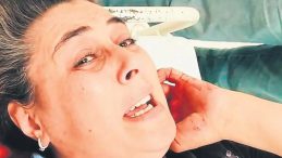 Eşini 3 Yerinden Bıçaklayıp Serbest Kaldı