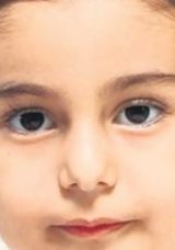 Oyuncak Mıknatısları Yuttu, Hayatı Tehlikeye Girdi