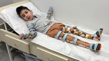 Sivrisinek Isırması Sonrası Hareketsiz Kalan Emir &Ouml;zbakan İ&ccedil;in Umut Belirdi!