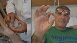 Akciğere Kaçan Diş İmplantı Şaşkınlık Yarattı: Genelde Çocuklarda Görülüyor